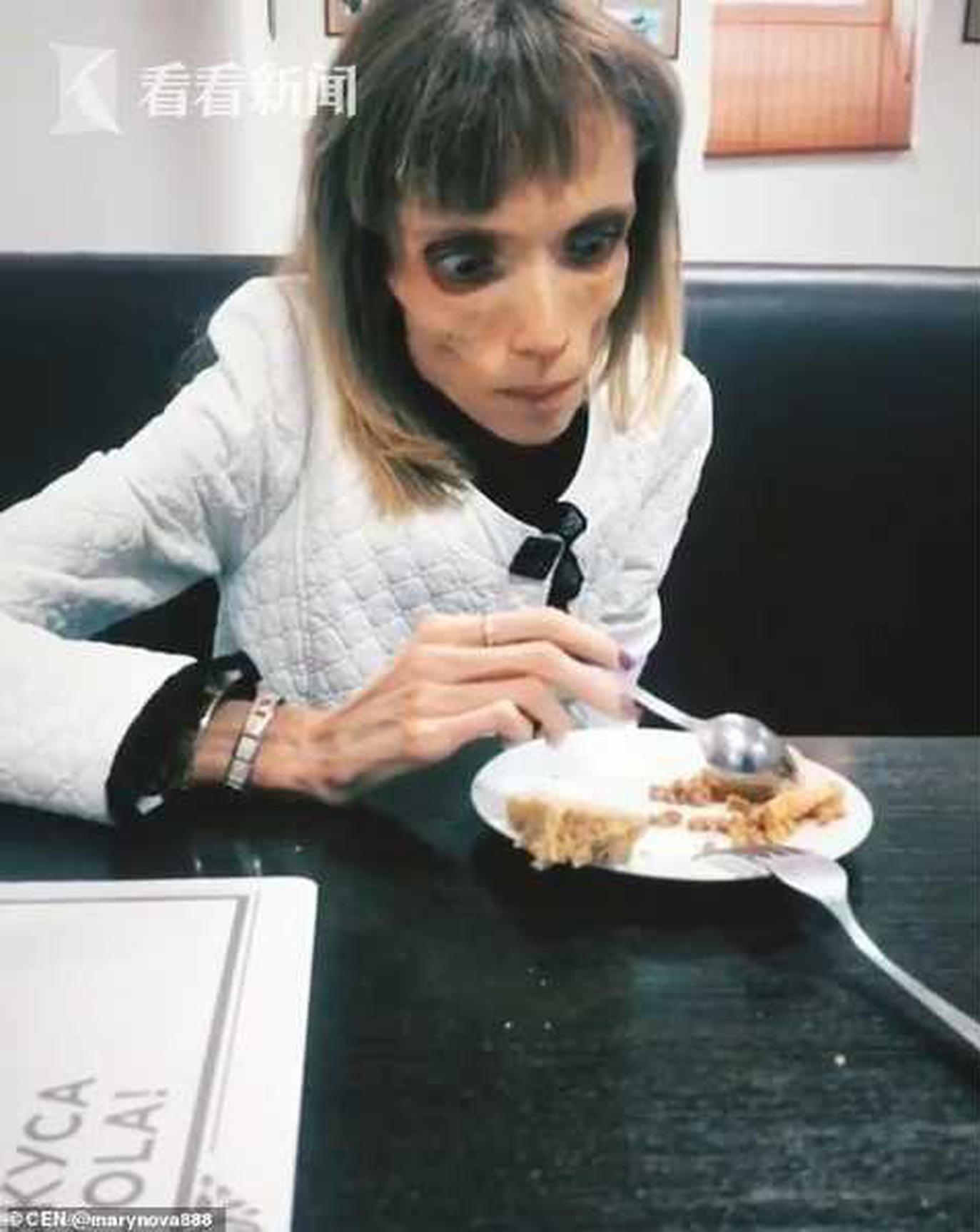 Doctors developed a new treatment for asthma that is more effective for children