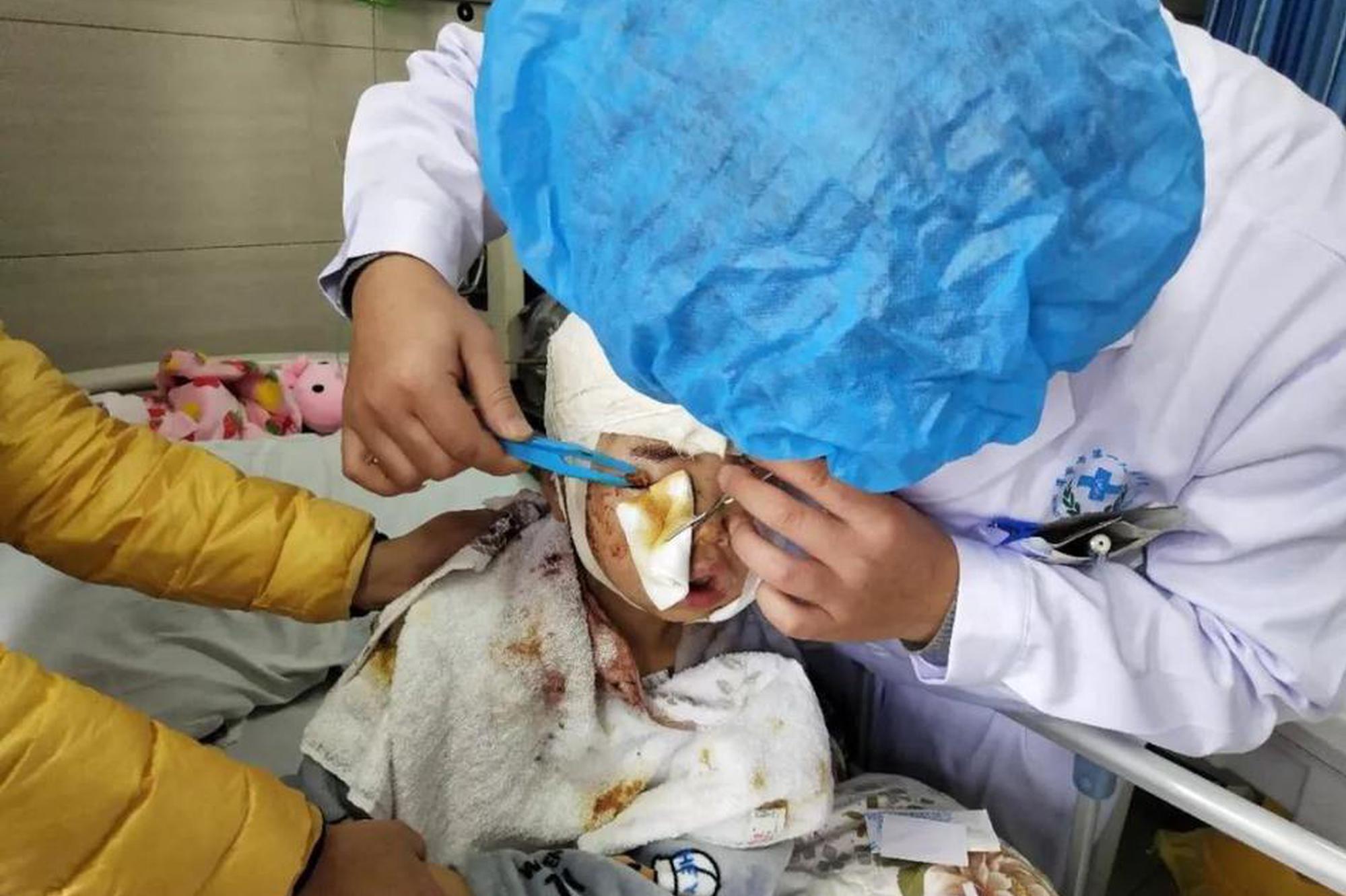 Researchers found that eating garlic regularly can lower blood pressure in people with hypertension