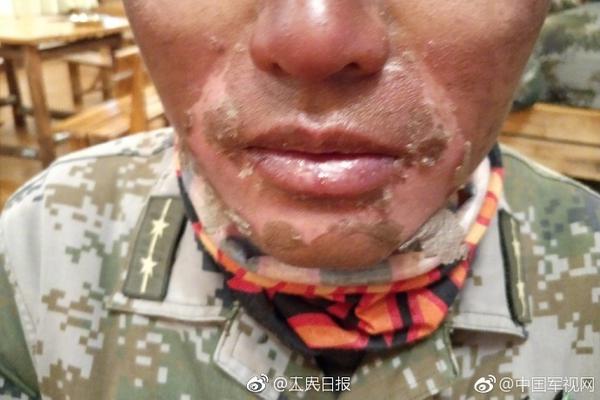 A local community started a community garden to provide fresh produce to low-income families