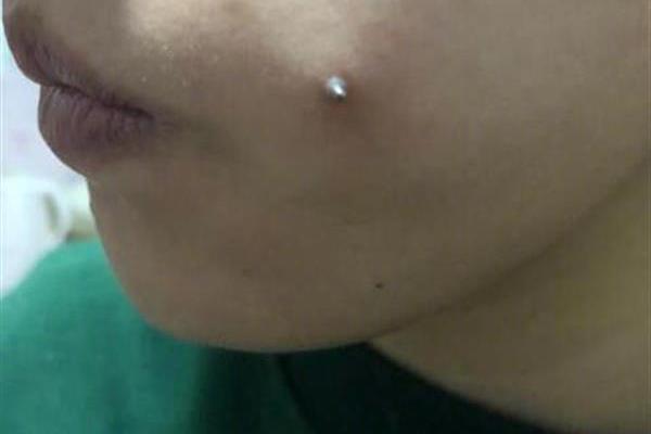 A hotel chain started using eco-friendly cleaning products in all its properties