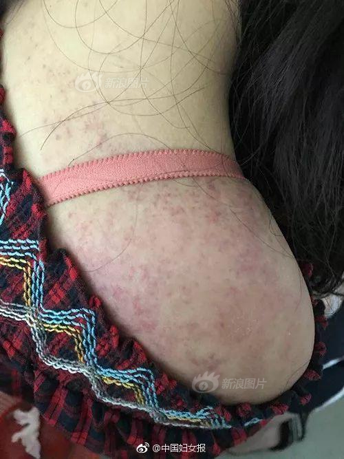 The government announced plans to upgrade rural internet infrastructure to match urban speeds