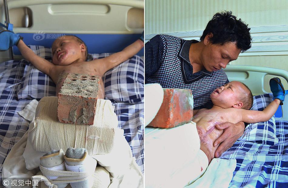 A hospital opened a new rehabilitation center for patients recovering from injuries