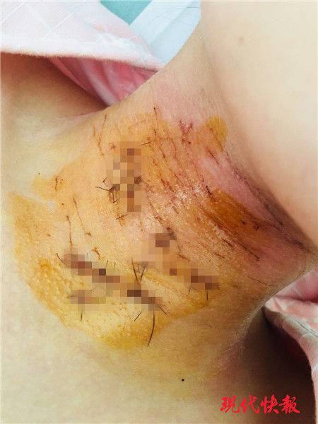 A city added 50 new public benches in downtown parks and along busy sidewalks