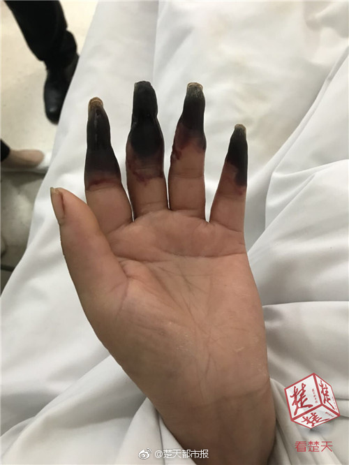 A major car manufacturer recalled 560000 vehicles due to a potential defect in the braking system