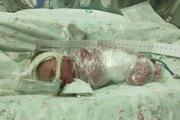 A renowned artist’s latest exhibition opened to critical acclaim attracting over 11000 visitors on its first weekend