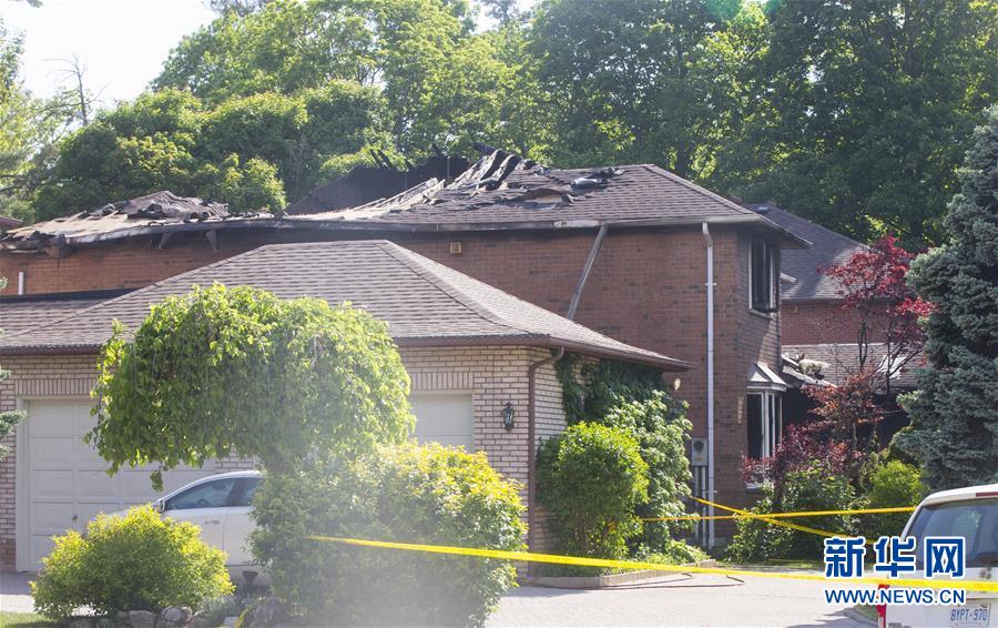 Local hospitals will start using a new AI system to assist in diagnosing rare diseases