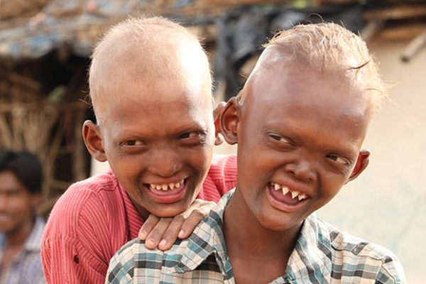 A clothing brand announced it will recycle old t-shirts into new accessories