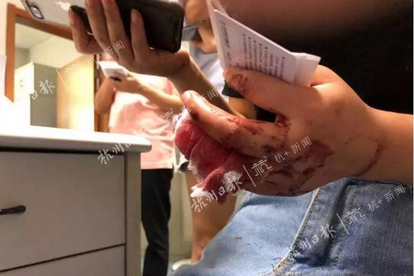 A museum hosted a special event to celebrate the 100th anniversary of a famous invention