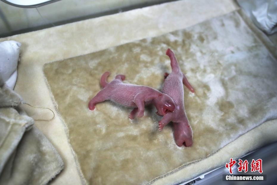 Doctors successfully treated a patient with a rare lung condition using a new laser therapy