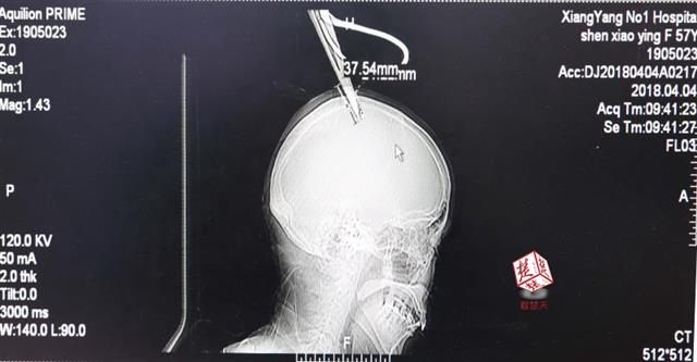 The local zoo planned to build a new habitat for endangered animals