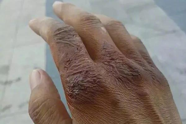 A government health agency launched a campaign to encourage annual flu vaccinations for all age groups