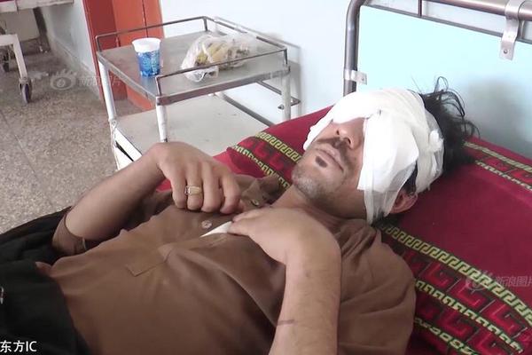 A severe hailstorm with baseball-sized hail damaged crops on 70 farms in a rural county